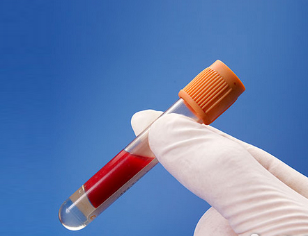 高血脂，隱秘的溫柔殺手